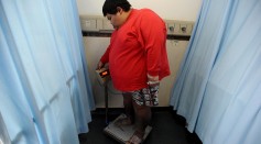  23-year-old Xu Han who weights 174 kilograms stands on a weighing machine at the First Affiliated Hospital of Chongqing Medical University on May 6, 2016 in Chongqing, China.