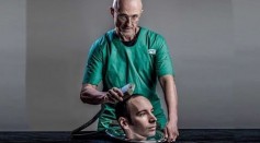 World's First Human Head Transplant