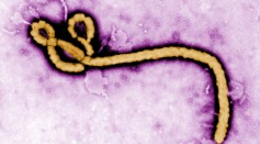 A colorized transmission electron micrograph (TEM) of a Ebola virus virion 