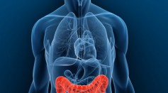 Colon Cancer is the third most common cancer in the U.S