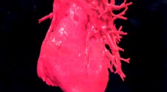 A Three-Dimensional (3-D) Image Displays A Computerized Visualization Of A Human Heart