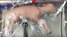 An artificial womb that successfully grew a preemie lamb was created by a team from the Children's Hospital of Philadelphia.