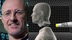 Major Obstacles Faces By The World's First Human Head Transplant 
