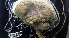 A real human brain being displayed as part of new exhibition at the science exhibition All About Us  on March 8, 2011 in Bristol, England. 