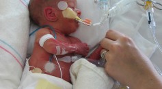 Premature baby covered with plastic materials