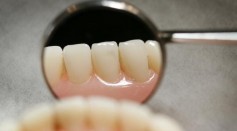 Teeth on a model denture set are reflected in a dental mirror on April 19, 2006 in Great Bookham, England