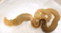 Human Limb Regeneration might be possible through studying the immortal acorn worm DNA.