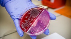 officer in charge of microbiology, holds a Petri dish that contains Escherichia coli bacteria