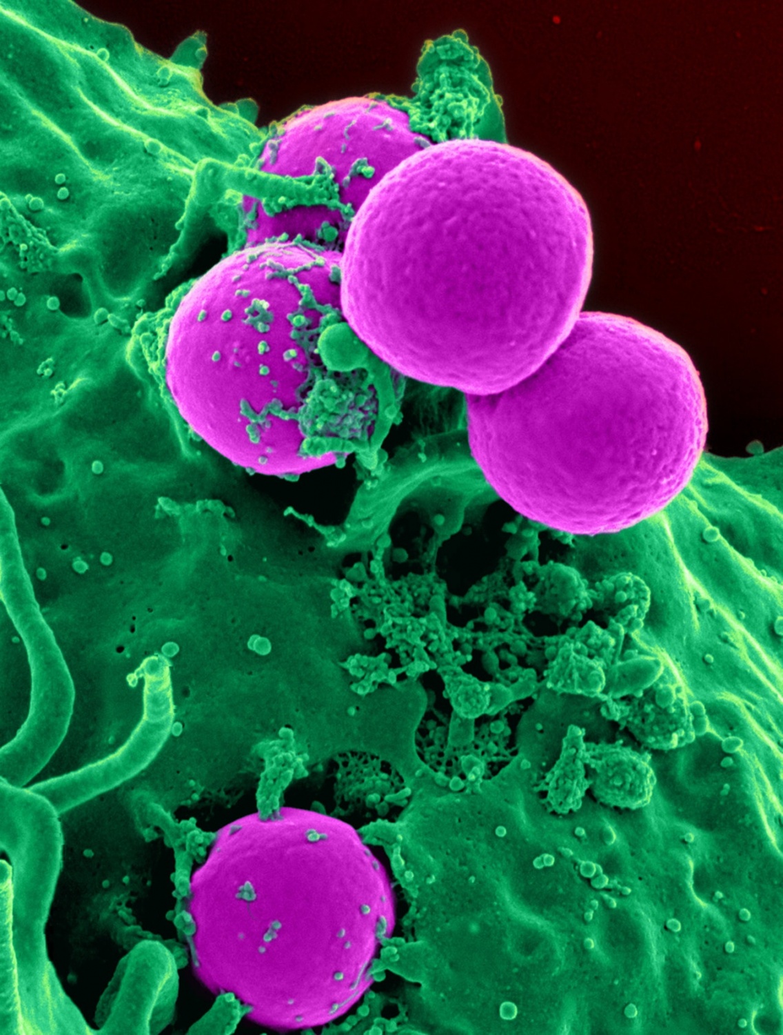 what-are-microbes-science-times