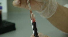 A new study claims that a person’s blood type may possibly influence the possibility of catching infectious diseases 