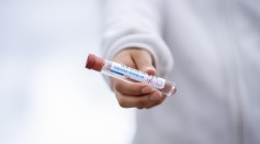 Antibody test