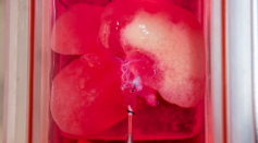 Bioengineered Miniature Human Livers Have Been Successfully Transplanted Into Ill Rats