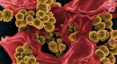 Berzosertib: Protein-Targeting Drug Used to Treat Cancer May Have Same Effect on Coronavirus