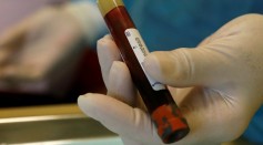 Birmingham University game-changer blood test for asymptomatic coronavirus patients