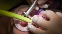 WHO Calls For Delaying Dental Routine Check-Ups Until COVID-19 Transmission Rates Drop