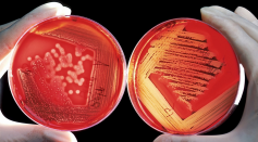 Science Times - Scientists Discover How to Fight Antibiotic-Resistant Bacteria