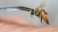 3 Types of Bee Venom Therapy