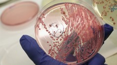 Health Authorities Seek Clues To EHEC Outbreak
