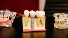 How Science Is Improving Oral Health