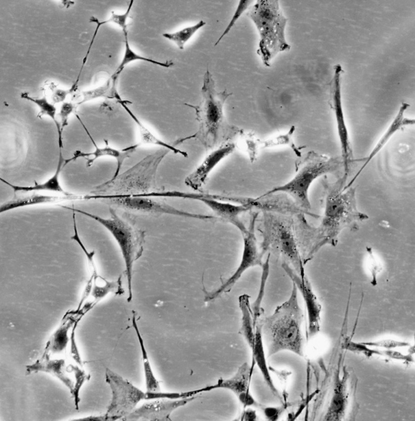 Stem Cells Open Doors To Greater Understanding Of Neurlogical Diseases