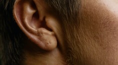 Researchers Assess Pre-Existing or Developed Tinnitus During the Pandemic