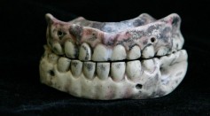 200 Year Old Dentures Displayed For World Smile Day
