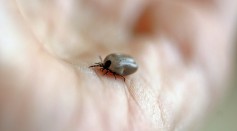 Science Times - Do You Expect Your Skin to be Toxic to Ticks, but It’s Not? Here’s Why, According to Science