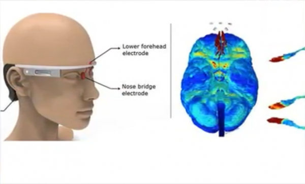 Scientists Invented A Wearable That Can Prevent Alzheimer's Disease