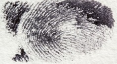 Sciences Times - 22-Year-Old Male Shares How Embarrassing It Is to Have no Fingerprints
