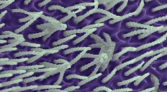 Microscopy of Nanofibers Spun by Spiders