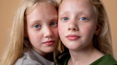 Science Times - Identical Twins Don’t Share the Same DNA All The Time, New Study Finds