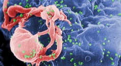 HIV Infection Electron Micrograph