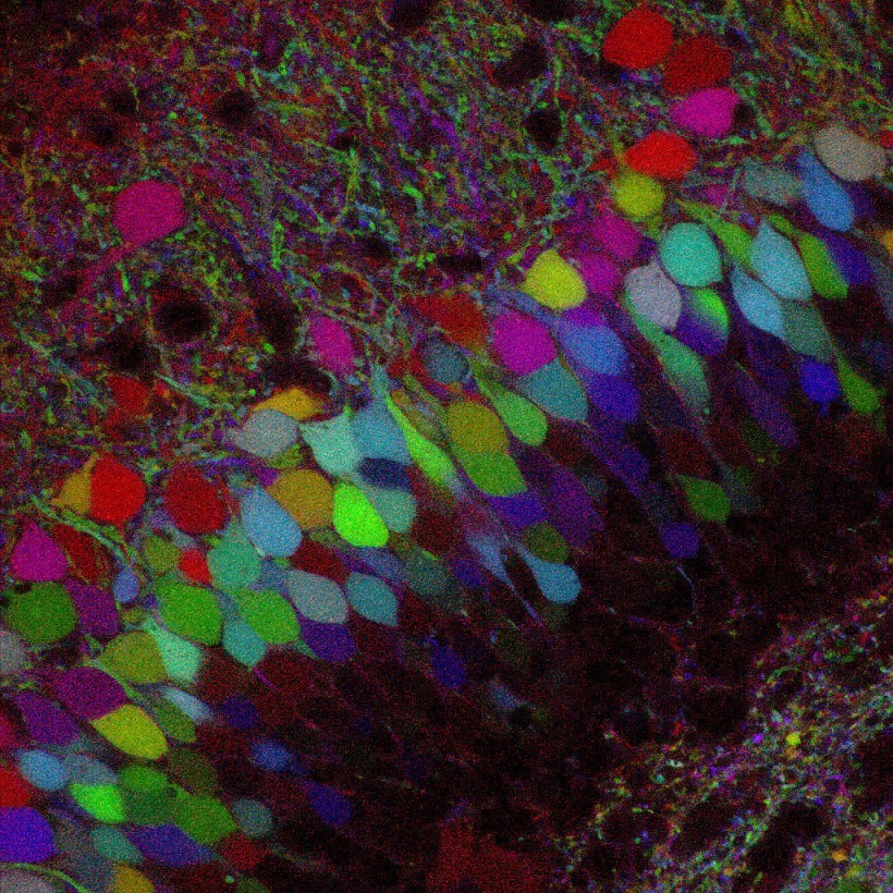 Image 2: neurons in the hippocampus