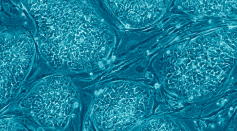 Human_embryonic_stem_cells_only_A.png
