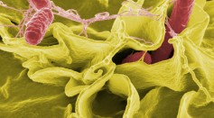  Mystery Salmonella Outbreak Strikes 127 People From 25 States, CDC Still Investigating Potential Source