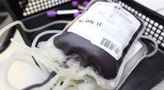  New Mathematical Model Shows Transfusions of Blood Substitutes Can Treat Anemic Patients, Solve Global Shortage