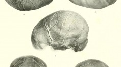 The brain from ape to man; a contribution to the study of the evolution and development of the human brain (1928)