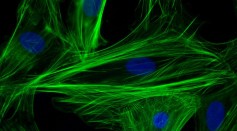 F-actin filaments in cardiomyocytes