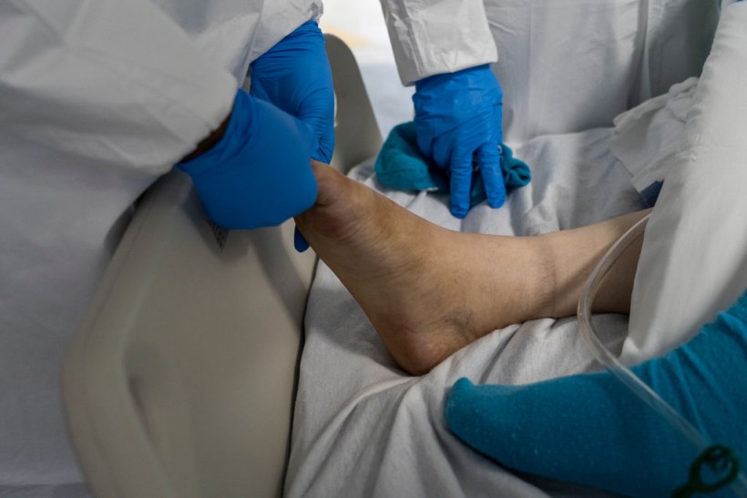 Patient's Foot 