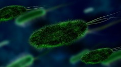  Shigella Outbreak in San Diego: Update on the Intestinal Infection Shows Increased Numbers With No Known Source Until Now