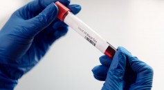 Science Times - Lung Cancer Risk Assessment: This Blood Test May Help Predict Who is Likely to Have the Chronic Illness