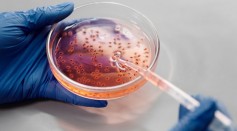 Science Times - Communities of Bacteria Organized in Biofilms Present in Sewer Pipes, Kitchen Counters, Human Teeth Found to be More Complex Than Thought