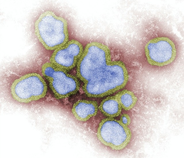 Science Times - 'Russian Flu' That Emerged in 1889, Possibly a Coronavirus; Scientists Found the Pandemic Seemed to Kill More Older Adults Than Children