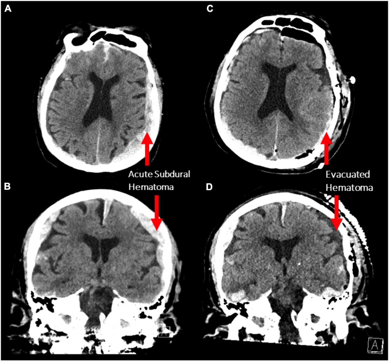 brain-s-final-moments-before-death-recorded-for-the-first-time-what