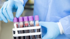 Persistent Lung Cancer: Personalized Blood Test Could Detect Tumor to Select Best Treatment Options