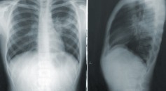  Explainable AI Accurately Labels X-Ray Images of Five Chest Pathologies Equivalent to Seven Human Experts
