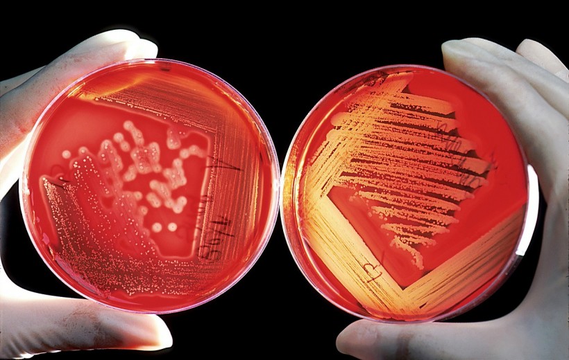  20 New Species of Bacteria With Antibiotic-Resistant Genes Discovered in Antarctica