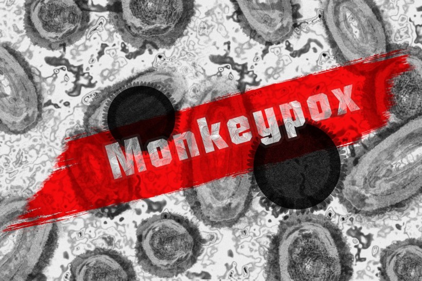 Monkeypox abstract representation