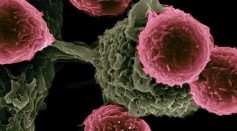  Cancer Treatment: Magnetic Nanoparticles Can Be Triggered to Release Anti-Cancer MicroRNA