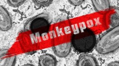  Arkansas Confirms Its First Monkeypox Case; US to Roll Out Nearly 300,000 Vaccines